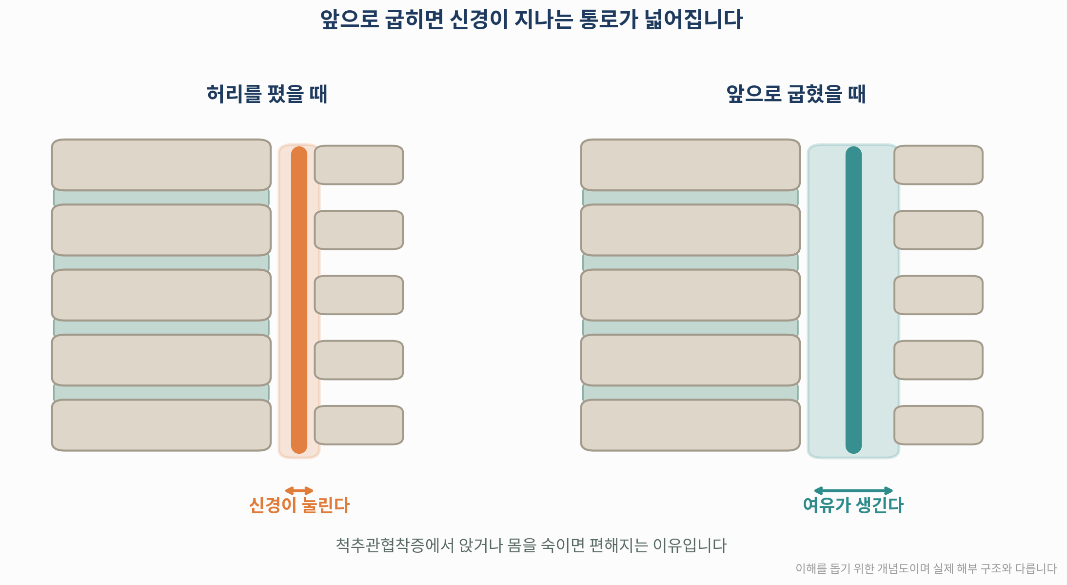 허리를 굽혔을 때 척추관이 넓어지는 원리