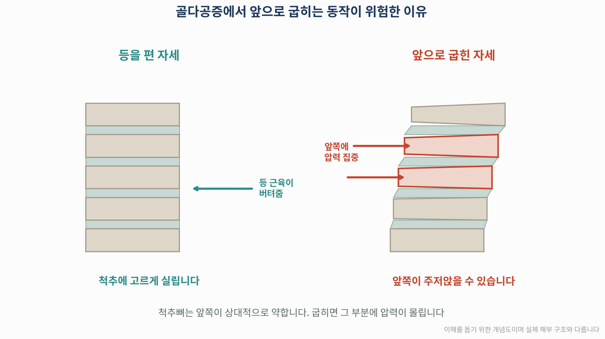 등을 편 자세와 굽힌 자세에서 척추에 실리는 압력 비교