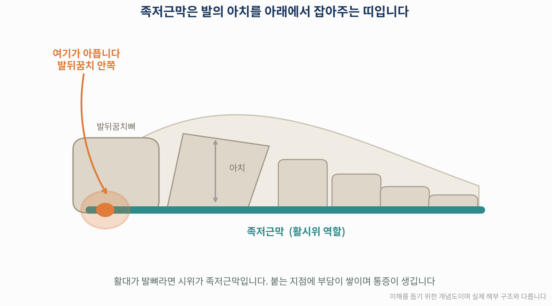 족저근막의 위치와 통증이 느껴지는 부위