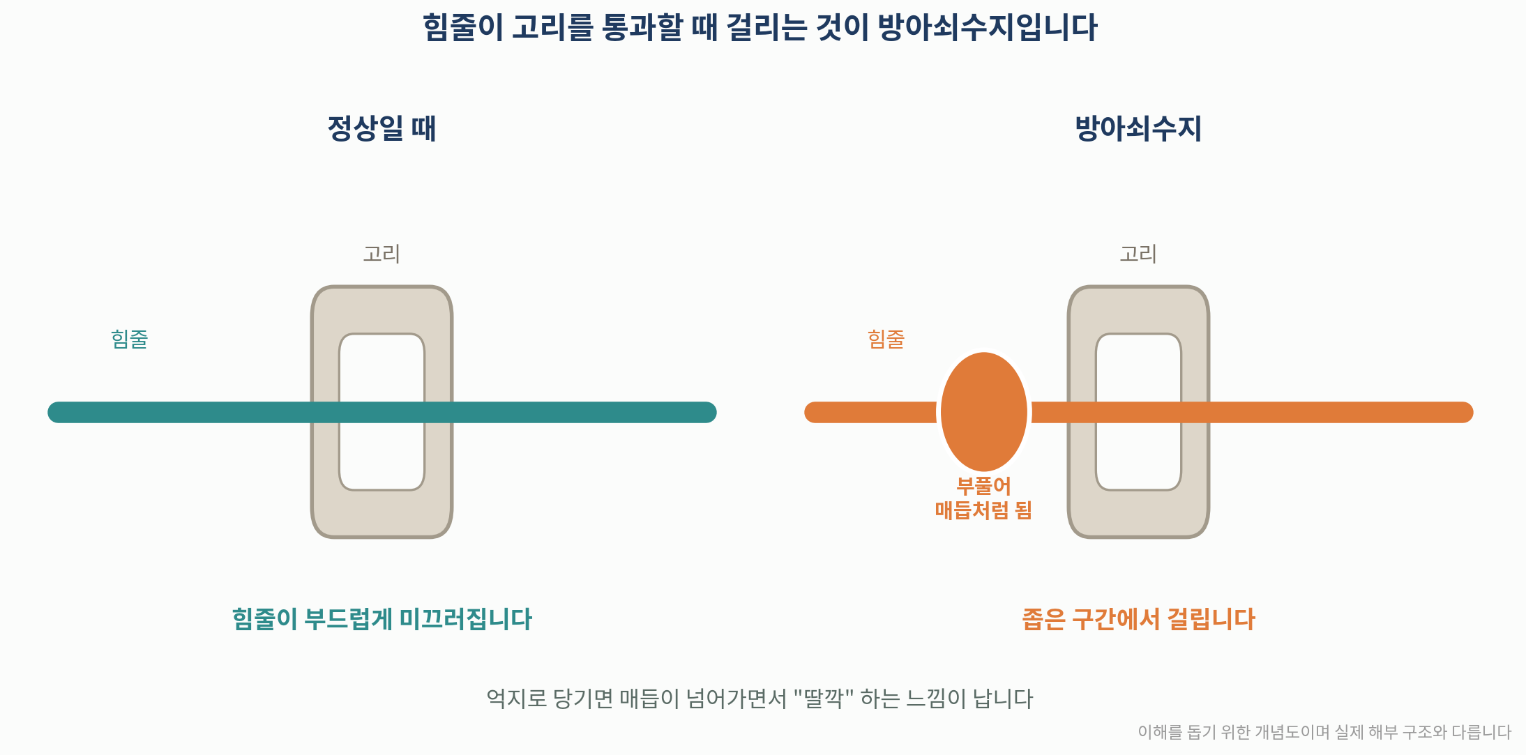 힘줄이 고리를 통과할 때 걸리는 원리